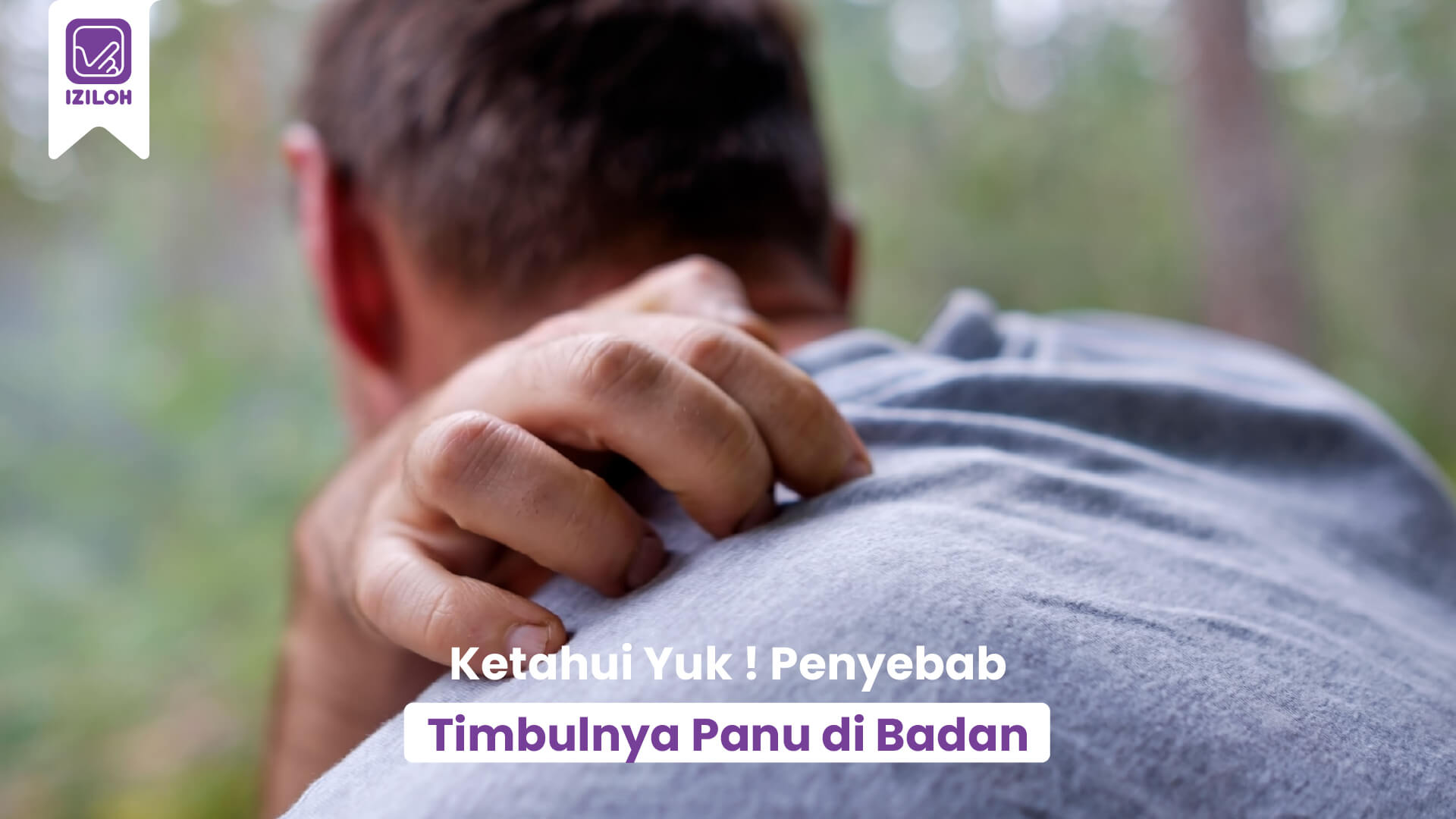 Beware ! 4 Penyebab Timbulnya Panu di Badan